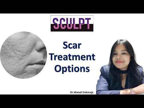 Best Skin Boosters in Guwahati | Dr. Manali Dekaraja | Best Scar Treatment Guwahati | Sculpt India