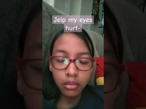 Tried to blink super fast, and now my eyes hurt
